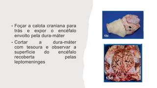 • Foçar a calota craniana para
trás e expor o encéfalo
envolto pela dura-máter
• Cortar a dura-máter
com tesoura e observar a
superfície do encéfalo
recoberta pelas
leptomeninges
 