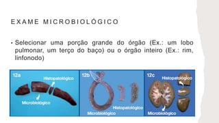 E X A M E M I C R O B I O L Ó G I C O
• Selecionar uma porção grande do órgão (Ex.: um lobo
pulmonar, um terço do baço) ou o órgão inteiro (Ex.: rim,
linfonodo)
 