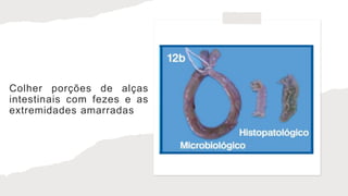 Colher porções de alças
intestinais com fezes e as
extremidades amarradas
 