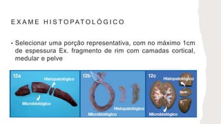 E X A M E H I S T O PAT O L Ó G I C O
• Selecionar uma porção representativa, com no máximo 1cm
de espessura Ex. fragmento de rim com camadas cortical,
medular e pelve
 