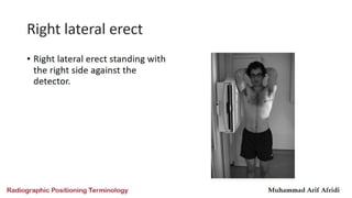 Radiographic positioning terminology  