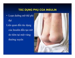 TÁC DỤNG PHỤ CỦA INSULIN
• Loạn dưỡng mỡ thể phì
đại
Liên quan đến tác dụng
của Insulin đến tạo mỡ
do tiêm tại một vùng
thường xuyên
 
