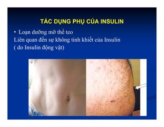 TÁC DỤNG PHỤ CỦA INSULIN
• Loạn dưỡng mỡ thể teo
Liên quan đến sự không tinh khiết của Insulin
( do Insulin động vật)
 