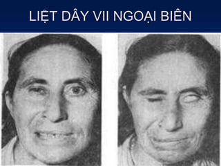 LIỆT DÂY VII NGOẠI BIÊN
 