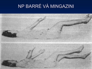 NP BARRÉ VÀ MINGAZINI
 