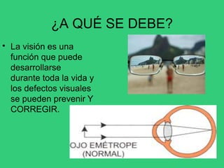¿A QUÉ SE DEBE?
• La visión es una
función que puede
desarrollarse
durante toda la vida y
los defectos visuales
se pueden prevenir Y
CORREGIR.
 
