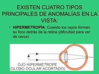 EXISTEN CUATRO TIPOS
PRINCIPALES DE ANOMALÍAS EN LA
VISTA:
• HIPERMETROPÍA: Cuando los rayos forman
su foco detrás de la retina (dificultad para ver
de cerca)
 