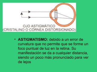 • ASTIGMATISMO: debido a un error de
curvatura que no permite que se forme un
foco puntual de luz en la retina. Su
manifestación se da a cualquier distancia,
siendo un poco más pronunciado para ver
de lejos
 