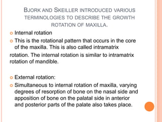 POST NATAL GROWTH AND DEVELOPMENT OF MAXILLA AND MANDIBLE | PPTX