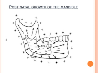 POST NATAL GROWTH AND DEVELOPMENT OF MAXILLA AND MANDIBLE | PPTX