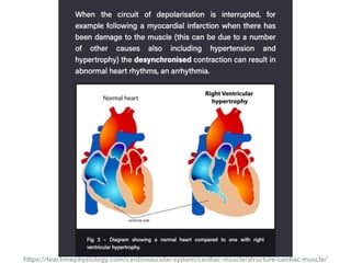 https://teachmephysiology.com/cardiovascular-system/cardiac-muscle/structure-cardiac-muscle/
 