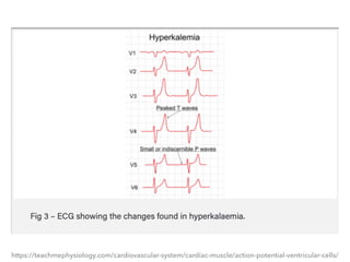 https://teachmephysiology.com/cardiovascular-system/cardiac-muscle/action-potential-ventricular-cells/
 