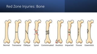 Injury & Rehabilitation (Part 1 of 3) | PPTX