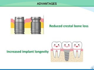 ADVANTAGES
Reduced crestal bone loss
Increased implant longevity
11
 