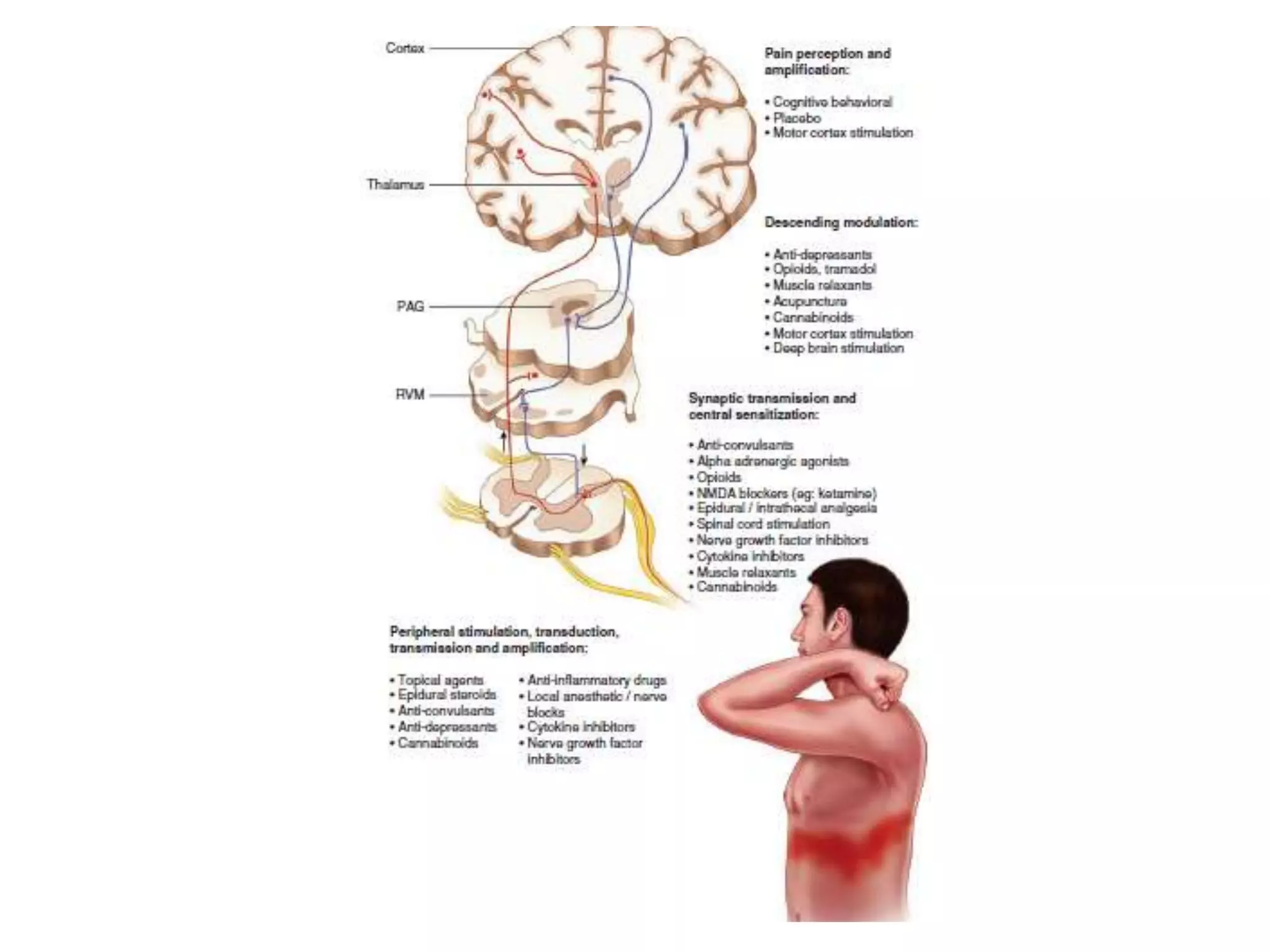 1.pain pathophysiology and mechanisms | PPTX