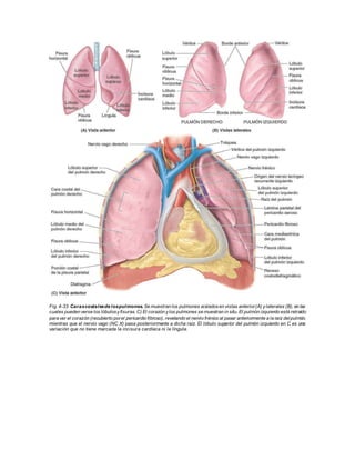 Fig. 4-33. Carascostalesde lospulmones. Se muestran los pulmones aisladosen vistas anterior(A) ylaterales (B), en las
cuales pueden verse los lóbulosyfisuras. C) El corazón ylos pulmones se muestran in situ. El pulmón izquierdo está retraído
para ver el corazón (recubierto porel pericardio fibroso), revelando el nervio frénico al pasar anteriormente a la raíz delpulmón,
mientras que el nervio vago (NC X) pasa posteriormente a dicha raíz. El lóbulo superior del pulmón izquierdo en C es una
variación que no tiene marcada la incisura cardíaca ni la língula.
 