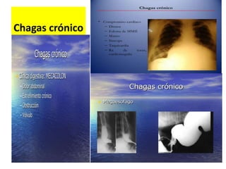 Chagas crónico
 
