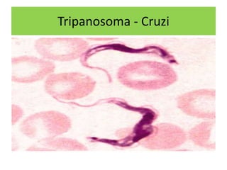 Tripanosoma - Cruzi
 