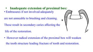 • Inadequate extension of proximal box:
• Embrasures if not involved adequately
are not amneable to brushing and cleaning.
These result in secondary caries affecting the
life of the restoration.
• However radical extension of the proximal box will weaken
the tooth structure leading fracture of tooth and restoration.
 
