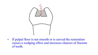 • If pulpal floor is not smooth or is curved the restoration
causes a wedging effect and increases chances of fracture
of tooth.
 