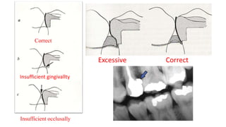 Excessive Correct
Correct
Insufficient gingivallty
Insufficient occlusally
 