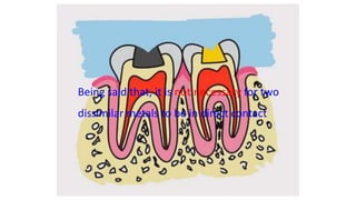 Being said that, it is not necessary for two
dissimilar metals to be in direct contact
 