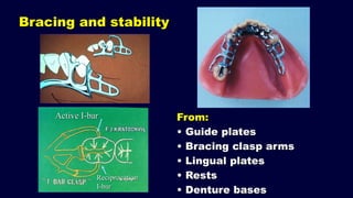 1. Introduction and forces acting on Removable Partial Denture (RPD ...