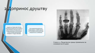 2.Допринос друштву
Слика 2.1. Рендгленски зраци примењени за
снимање кости шаке
РАДОМ НА ТЕМИ ЕЛЕКТРИЧЕН
РЕЗОНАНЦЕ МИХАЈЛО ЈЕ ИЗУМЕО
ЕЛЕКТРИЧНО СТРУЈНО КОЛО СА
ПОДЕШАВАЊЕМУ РЕЗОНАНЦИ,
КОЈЕ КАСНИЈЕ ПРОНАЛАЗИ
ПРИМЕНУ У РАДИО-ВЕЗАМА.
СЕКУНДАРНЕРЕНДГЕНСКЕ
РАДИЈАЦИЈЕ, А УБРЗО НАКОН
ТОГА ИЗУМЕО ЈЕ БРЗУ МЕТОДУ
РЕНДГЕНСКОГСНИМАЊА
 