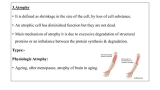 3.Atrophy
• It is defined as shrinkage in the size of the cell, by loss of cell substance.
• An atrophic cell has diminished function but they are not dead.
• Main mechanism of atrophy it is due to excessive degradation of structural
proteins or an imbalance between the protein synthesis & degradation.
Types:-
Physiologic Atrophy:
• Ageing, after menopause, atrophy of brain in aging.
 