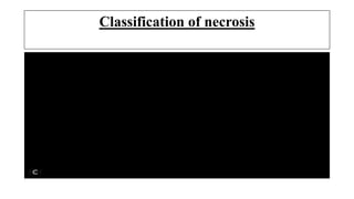 Classification of necrosis
 