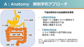 A：Anatomy 解剖学的アプローチ
下血の性状から出血部位を想定
• 上部消化管出血
食道～十二指腸トライツ靱帯まで
黒色から暗赤色の下血
胃酸に曝露するため
• 下部消化管出血
トライツ靱帯から肛門側の出血
暗赤色～赤色
ただし、ショックに至るような大量出血では上部消化管出血で
あっても胃酸の影響を受けにくく、暗赤色～赤色の色調となる
ので注意
食道
胃
十二指腸
トライツ靱帯
空腸～回腸 大腸
直腸 肛門
 