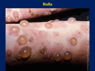 Bulla Photo Skin terminologies.ppt