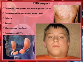 РНК вируси
 Спирално симетричан или полихедричан капсид
 Спољашњи омотач (липиди и протеини)
 Рубеоле
 Заушке
 Мале богиње (морбили)
 Ретровируси (HIV)
 