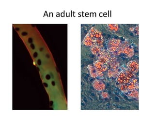 An adult stem cell
 