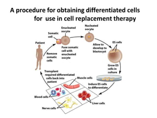 A procedure for obtaining differentiated cells
for use in cell replacement therapy
 