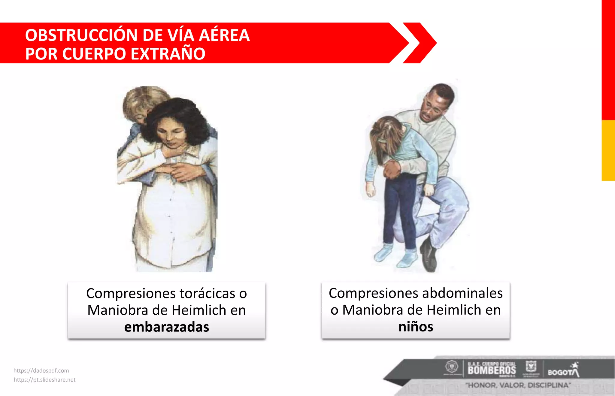 Compresiones torácicas o
Maniobra de Heimlich en
embarazadas
https://dadospdf.com
Compresiones abdominales
o Maniobra de Heimlich en
niños
https://pt.slideshare.net
OBSTRUCCIÓN DE VÍA AÉREA
POR CUERPO EXTRAÑO
 