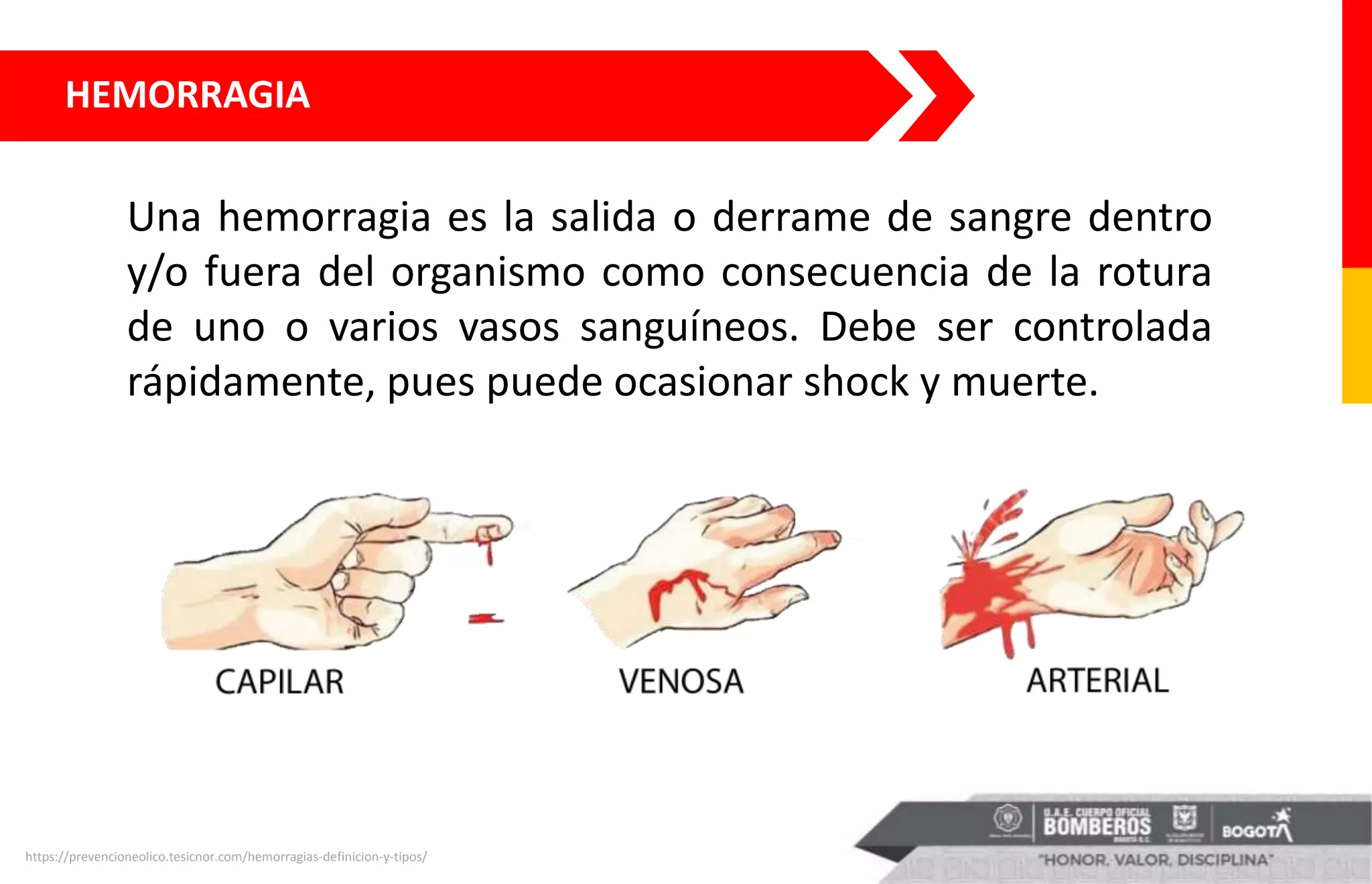 HEMORRAGIA
Una hemorragia es la salida o derrame de sangre dentro
y/o fuera del organismo como consecuencia de la rotura
de uno o varios vasos sanguíneos. Debe ser controlada
rápidamente, pues puede ocasionar shock y muerte.
https://prevencioneolico.tesicnor.com/hemorragias-definicion-y-tipos/
 