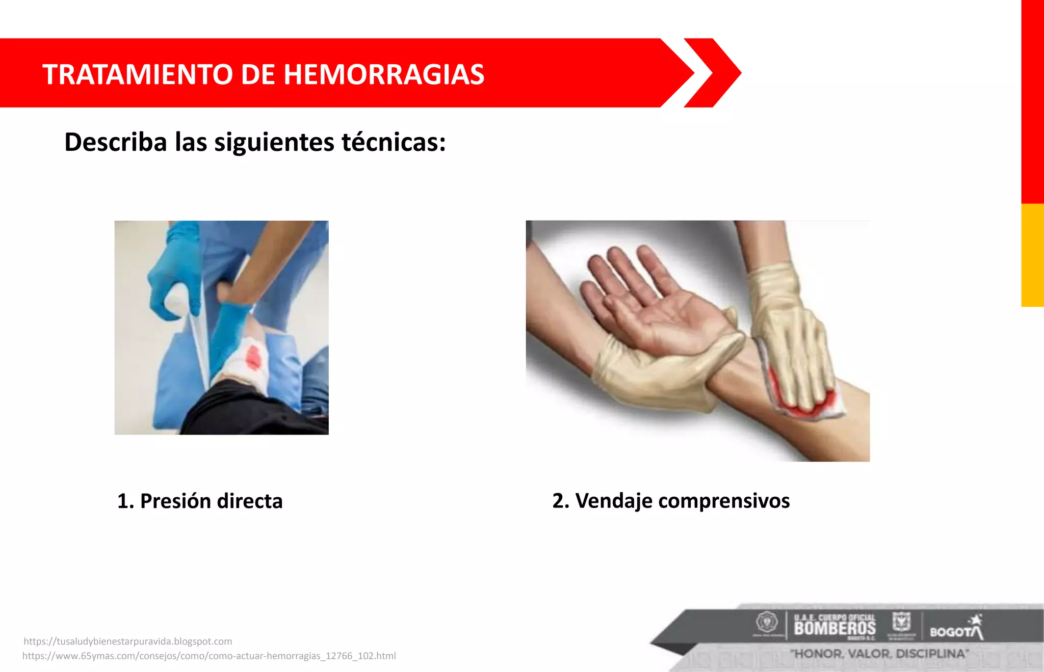 TRATAMIENTO DE HEMORRAGIAS
Describa las siguientes técnicas:
1. Presión directa
https://tusaludybienestarpuravida.blogspot.com
2. Vendaje comprensivos
https://www.65ymas.com/consejos/como/como-actuar-hemorragias_12766_102.html
 