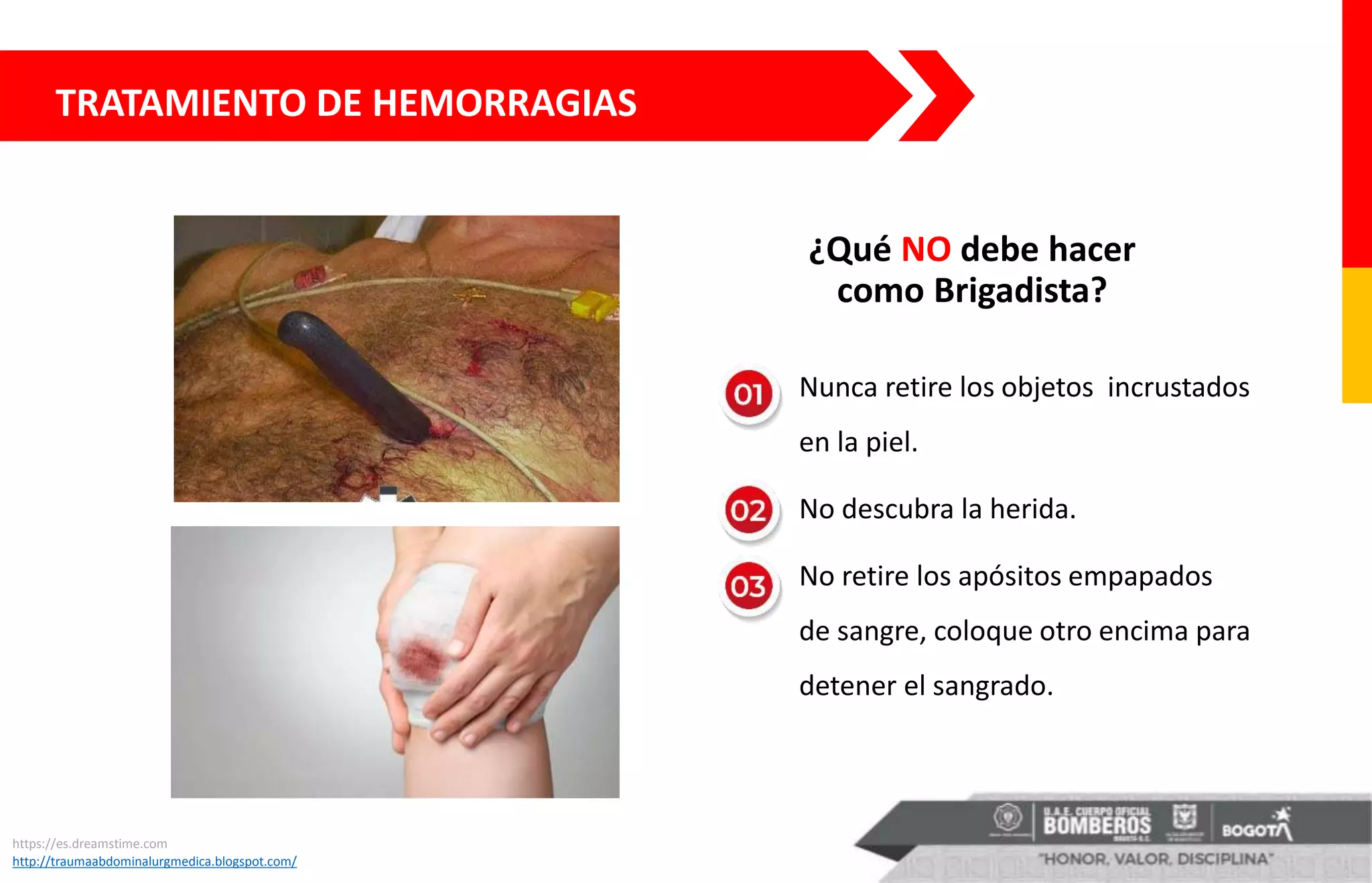 TRATAMIENTO DE HEMORRAGIAS
¿Qué NO debe hacer
como Brigadista?
• Nunca retire los objetos incrustados
en la piel.
• No descubra la herida.
• No retire los apósitos empapados
de sangre, coloque otro encima para
detener el sangrado.
https://es.dreamstime.com
http://traumaabdominalurgmedica.blogspot.com/
 