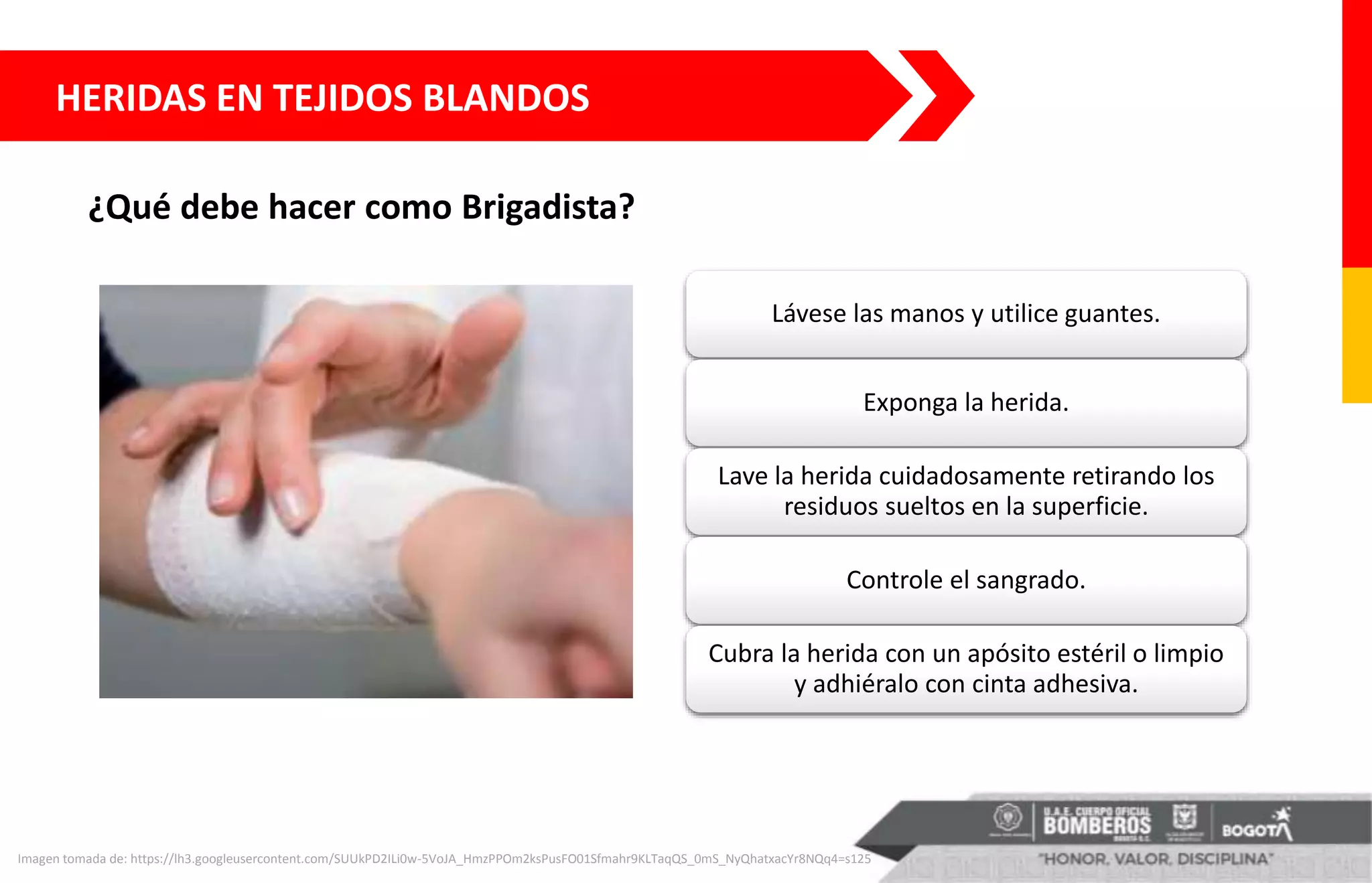 HERIDAS EN TEJIDOS BLANDOS
¿Qué debe hacer como Brigadista?
Imagen tomada de: https://lh3.googleusercontent.com/SUUkPD2ILi0w-5VoJA_HmzPPOm2ksPusFO01Sfmahr9KLTaqQS_0mS_NyQhatxacYr8NQq4=s125
Lávese las manos y utilice guantes.
Exponga la herida.
Lave la herida cuidadosamente retirando los
residuos sueltos en la superficie.
Controle el sangrado.
Cubra la herida con un apósito estéril o limpio
y adhiéralo con cinta adhesiva.
 
