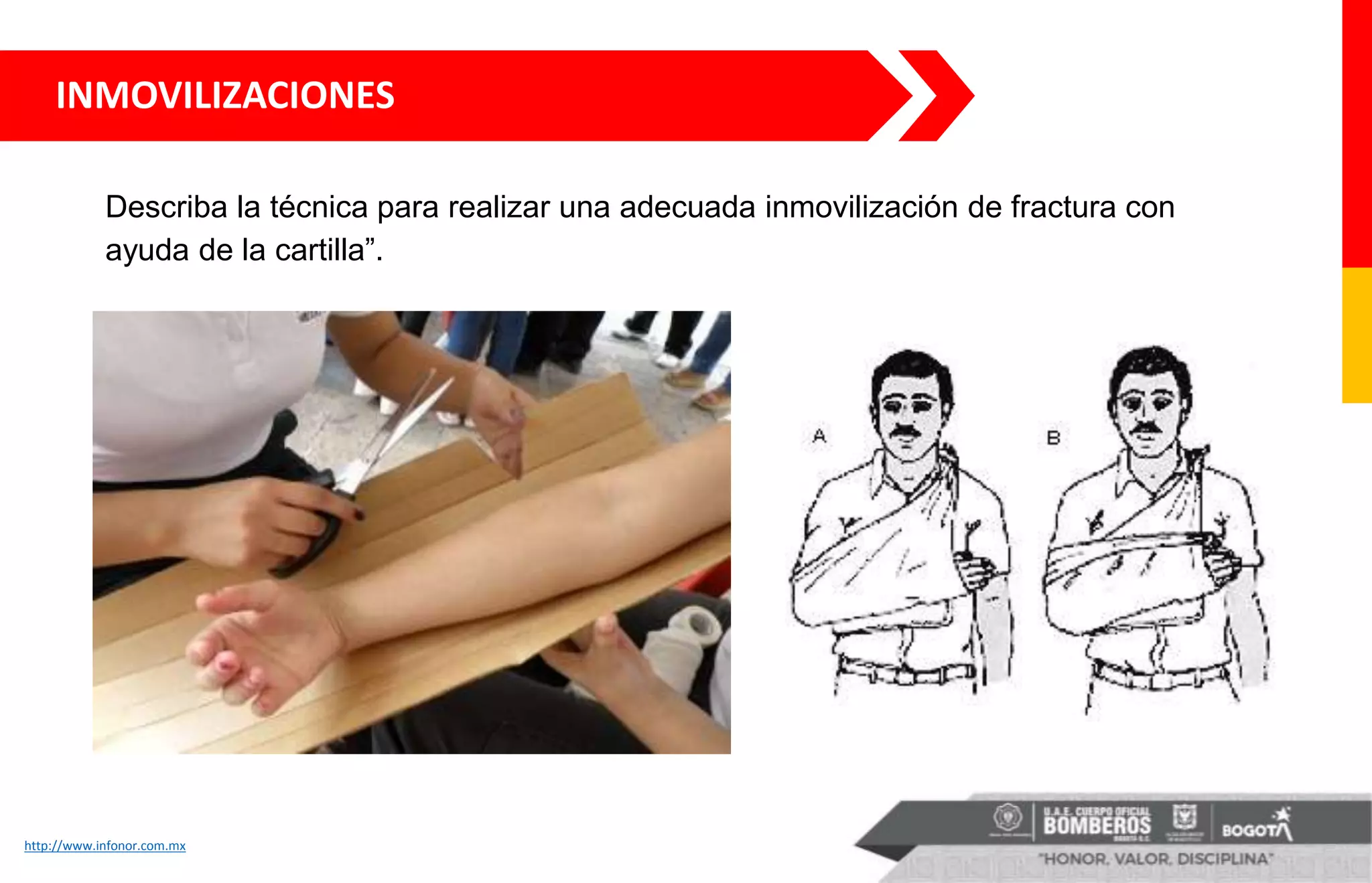 INMOVILIZACIONES
http://www.infonor.com.mx
Describa la técnica para realizar una adecuada inmovilización de fractura con
ayuda de la cartilla”.
 
