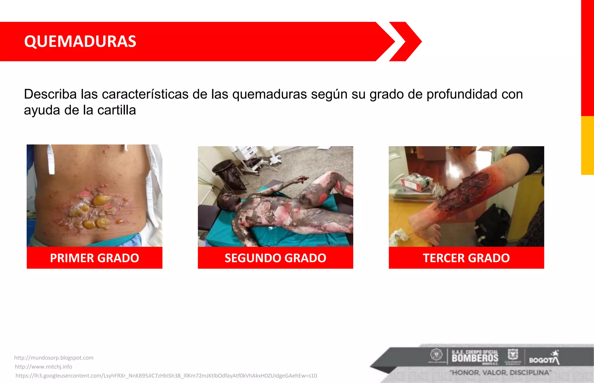 https://lh3.googleusercontent.com/LsyhFRXr_NnKB95JIC7zHbISh38_lllKm72mJKtlbOdfayAtf0kVhAkxH0ZUIdgeGAehEw=s10
http://mundosorp.blogspot.com
http://www.mitchj.info
QUEMADURAS
PRIMER GRADO SEGUNDO GRADO TERCER GRADO
Describa las características de las quemaduras según su grado de profundidad con
ayuda de la cartilla
 