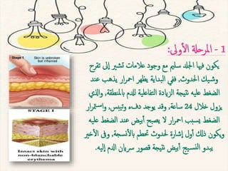 bed sores | PPT