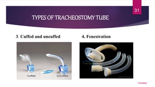 TYPES OF TRACHEOSTOMY TUBE
3. Cuffed and uncuffed 4. Fenestration
7/24/2022
31
 