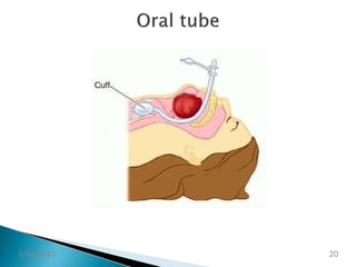 ET TUBE intubation | PPTX