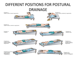 DIFFERENT POSITIONS FOR POSTURAL
DRAINAGE
31
7/24/2022
 