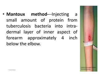 • Mantoux method---Injecting a
small amount of protein from
tuberculosis bacteria into intra-
dermal layer of inner aspect of
forearm approximately 4 inch
below the elbow.
44
7/24/2022
 