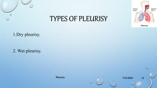 TYPES OF PLEURISY
1.Dry pleurisy.
2. Wet pleurisy.
7/24/2022
Pleurisy 11
 