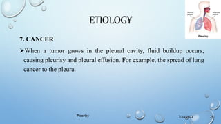 ETIOLOGY
7. CANCER
When a tumor grows in the pleural cavity, fluid buildup occurs,
causing pleurisy and pleural effusion. For example, the spread of lung
cancer to the pleura.
7/24/2022
Pleurisy 25
 