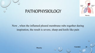 PATHOPHYSIOLOGY
Now , when the inflamed pleural membrane rubs together during
inspiration, the result is severe, sharp and knife like pain
7/24/2022
Pleurisy
29
 